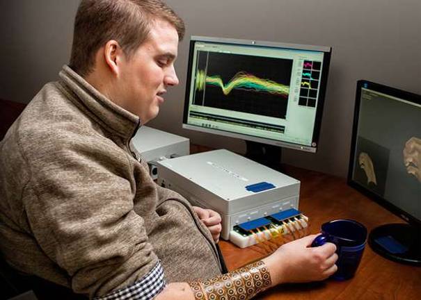 Study: Brain implant lets paralyzed man regain use of hand Ian Burkhart (Photo: The Ohio State University)